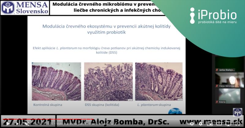 MENSA Slovensko - Online klubovňa o úlohe črevného mikrobiómu pri podpore nášho zdravia v prevencii vzniku a rozvoja chorôb